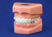 セルフライゲーション 名古屋市瑞穂区で歯の矯正なら桜山矯正歯科へ